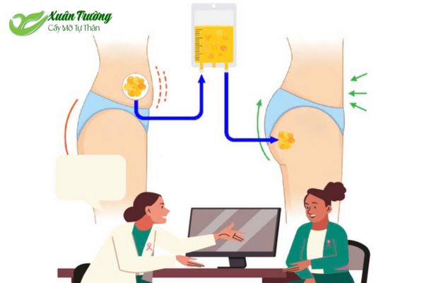 Quy trình cấy mỡ tự thân tại Thẩm Mỹ Xuân Trường