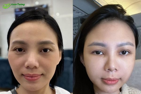 Cây mỡ trán giúp tăng sự tự tin với vẻ ngoài tươi trẻ, hài hòa.