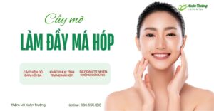 Cay mo lam day ma hop