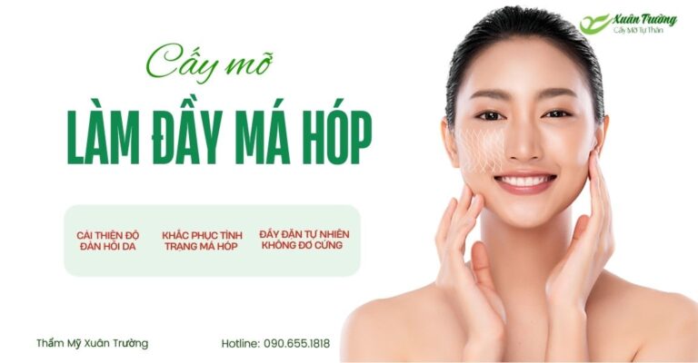 Cay mo lam day ma hop