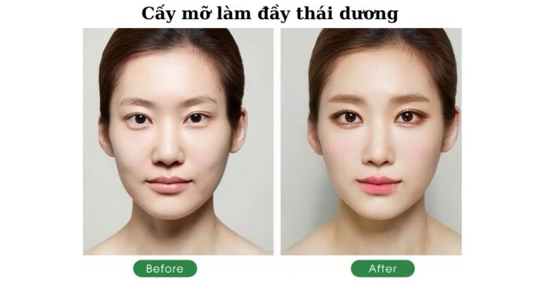 Cay mo lam day thai duong