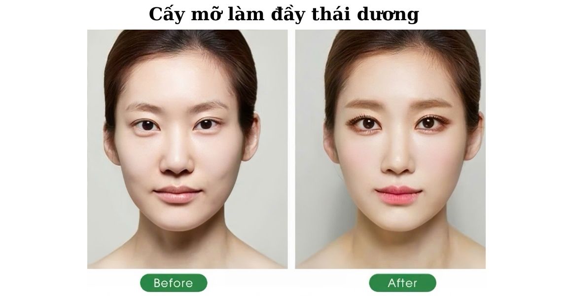 Cay mo lam day thai duong