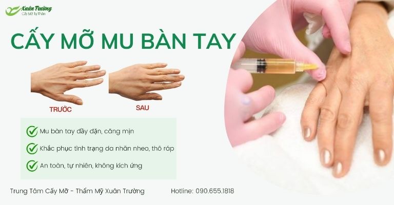 Cay mo mu ban tay