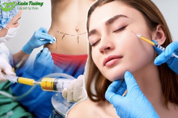Lấy mỡ từ bụng hoặc đùi bằng công nghệ hiện đại.