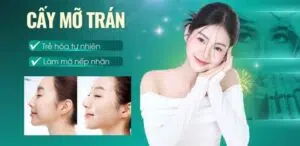 Cấy mỡ trán giá bao nhiêu