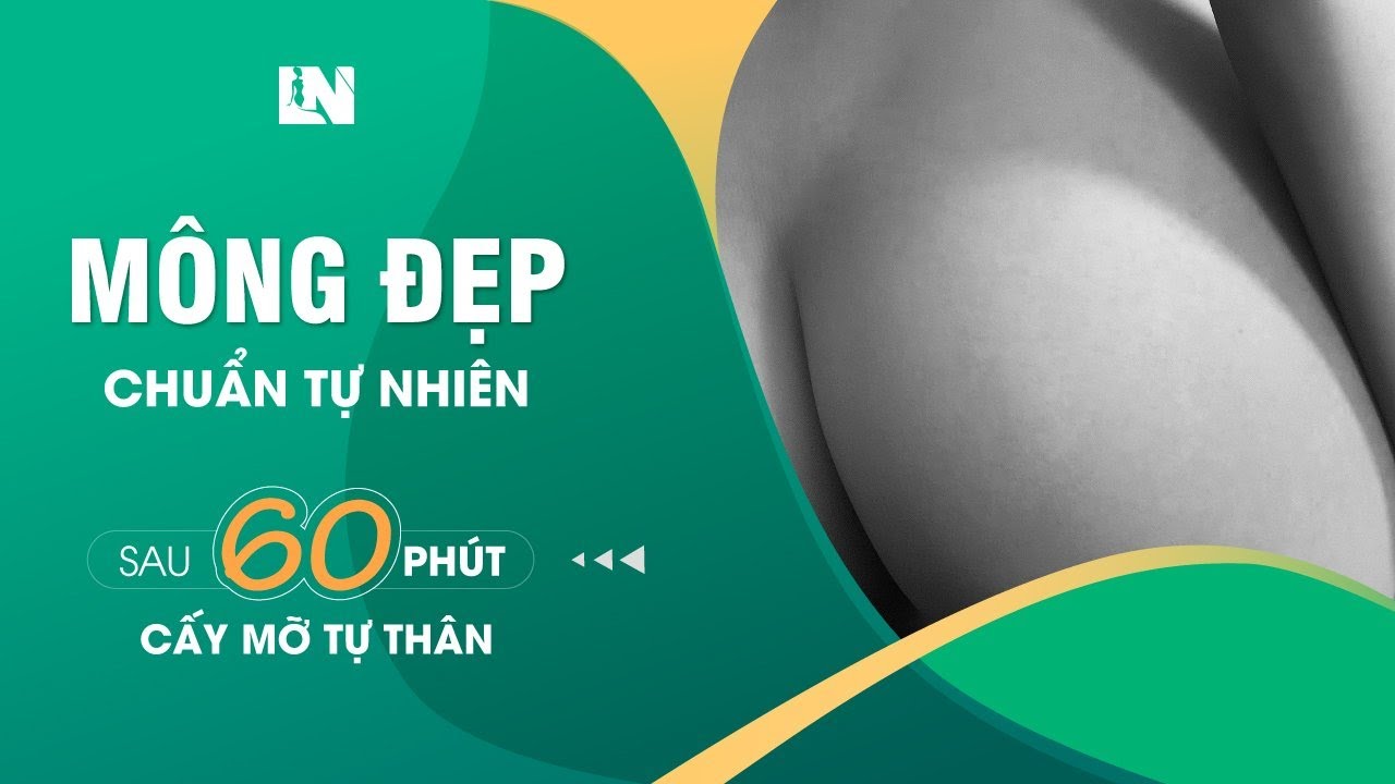 Cấy Mỡ Mông Giữ Được Bao Lâu? Bí Quyết Tăng Vòng 3 Hiệu Quả Và An Toàn