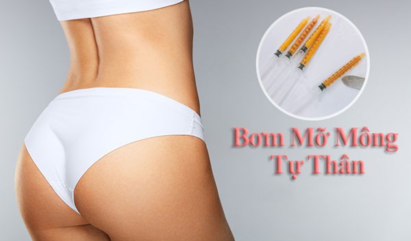 Cấy Mỡ Mông Giữ Được Bao Lâu? Bí Quyết Tăng Vòng 3 Hiệu Quả Và An Toàn