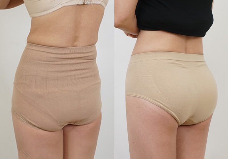 Cấy Mỡ Mông Giữ Được Bao Lâu? Bí Quyết Tăng Vòng 3 Hiệu Quả Và An Toàn
