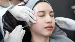 Tiêm prp cho da mặt