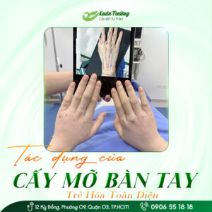 Đôi tay trẻ trung, tự tin khoe cá tính.