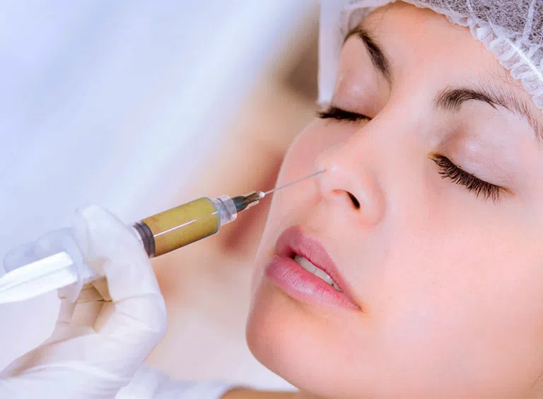 Cấy mỡ trung bì mũi Cấy mỡ trung bì mũi giá bao nhiêu