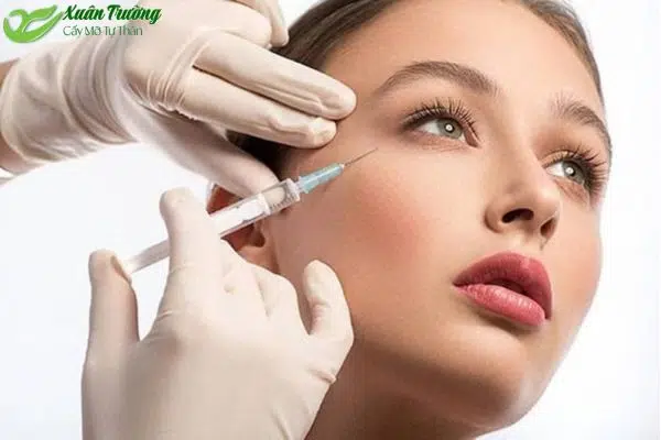 Phương pháp cấy mỡ tự thân lên mặt giúp đầy đặn tự nhiên