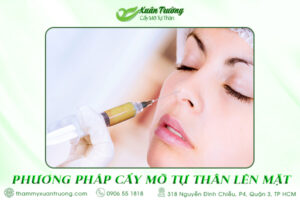phương pháp cấy mỡ tự thân lên mặt