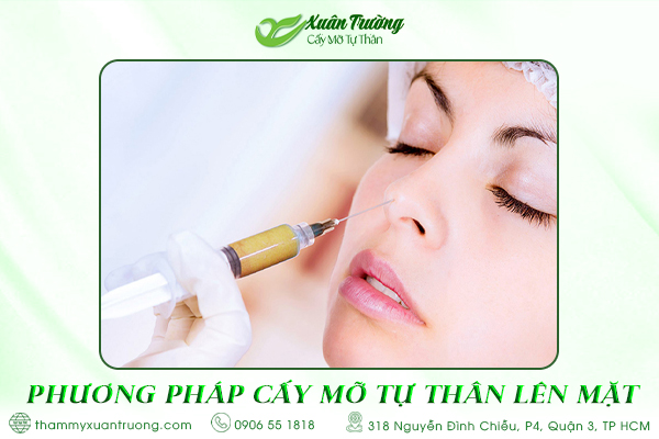 phương pháp cấy mỡ tự thân lên mặt