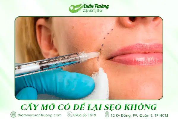 cấy mỡ có để lại sẹo không