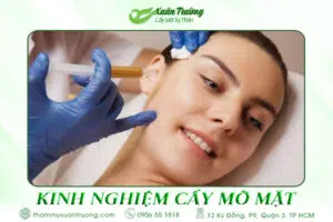 kinh nghiệm cấy mỡ mặt