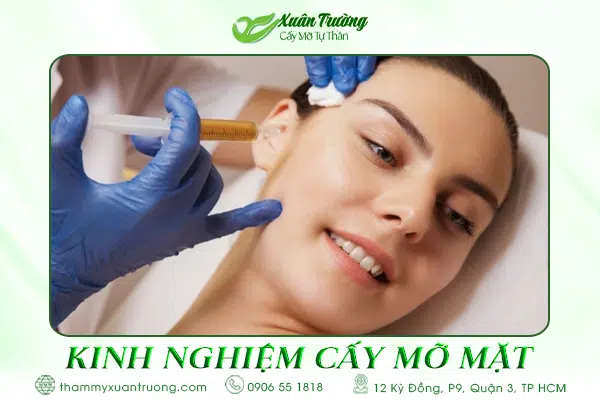kinh nghiệm cấy mỡ mặt