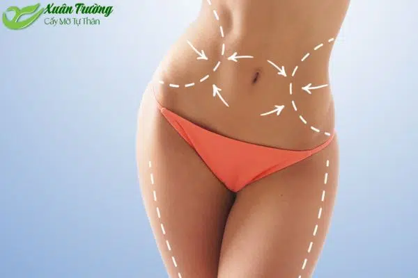 Mô phỏng quy trình lấy mỡ từ đùi hoặc bụng
