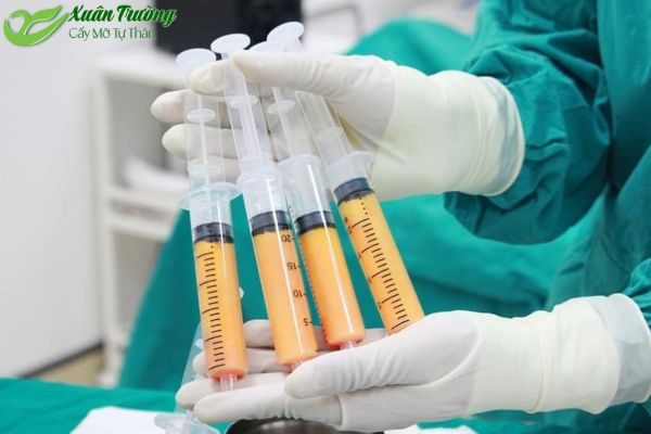 Bác sĩ đang chiết tách mỡ tự thân an toàn, chuẩn vô trùng.