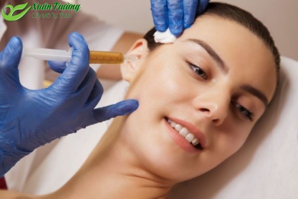 Làm đầy má hóp bằng mỡ tự thân giúp gương mặt trẻ trung hơn.