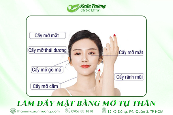Làm đầy mặt bằng mỡ tự thân