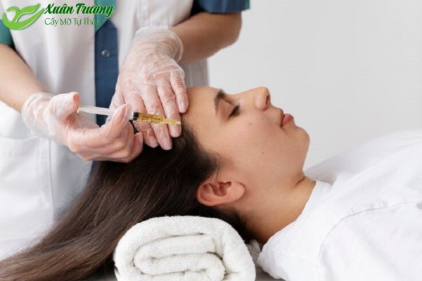 Quy trình làm đầy thái dương chuẩn y khoa.