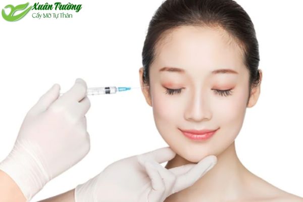 Trẻ trung, hài hòa hơn sau khi làm đầy thái dương bằng mỡ tự thân