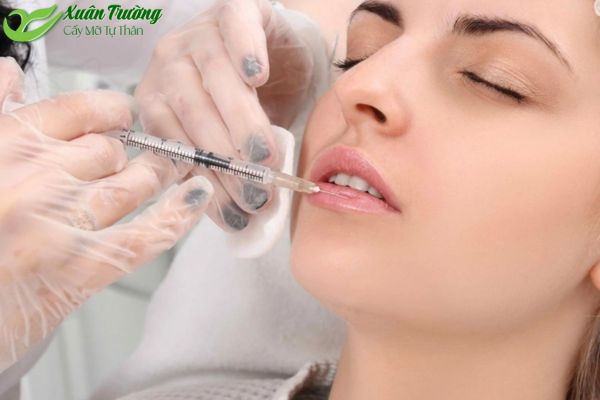 Tiêm filler nhanh chóng, hiệu quả thấy rõ ngay sau thực hiện