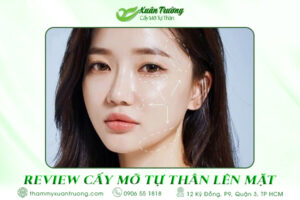 Review cấy mỡ tự thân lên mặt