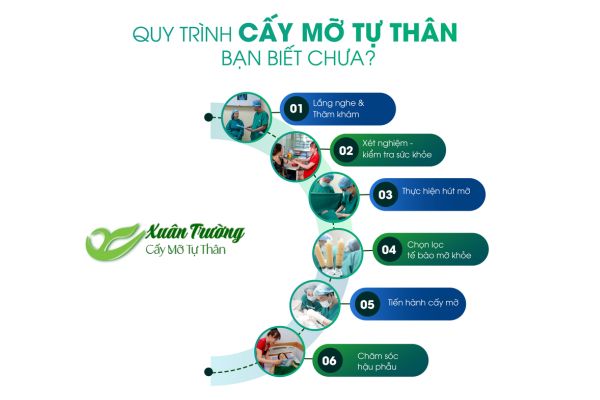 Quy trình cấy mỡ tự thân an toàn tại phòng khám uy tín
