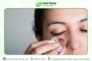 Cách giảm sưng nhanh sau cấy mỡ mặt