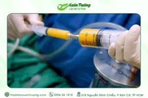 cấy mỡ có bị tiêu không