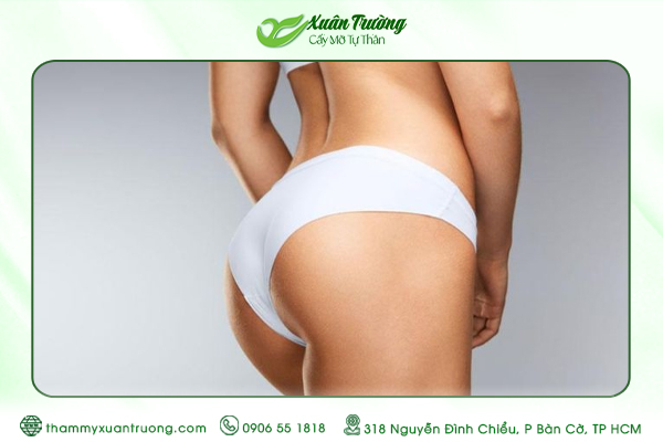 Chăm sóc sau cấy mỡ mông