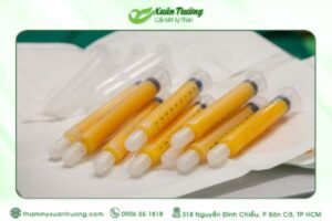 cấy mỡ bị vón cục