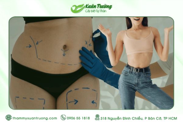 Có nên hút mỡ bụng để cấy lên mặt không